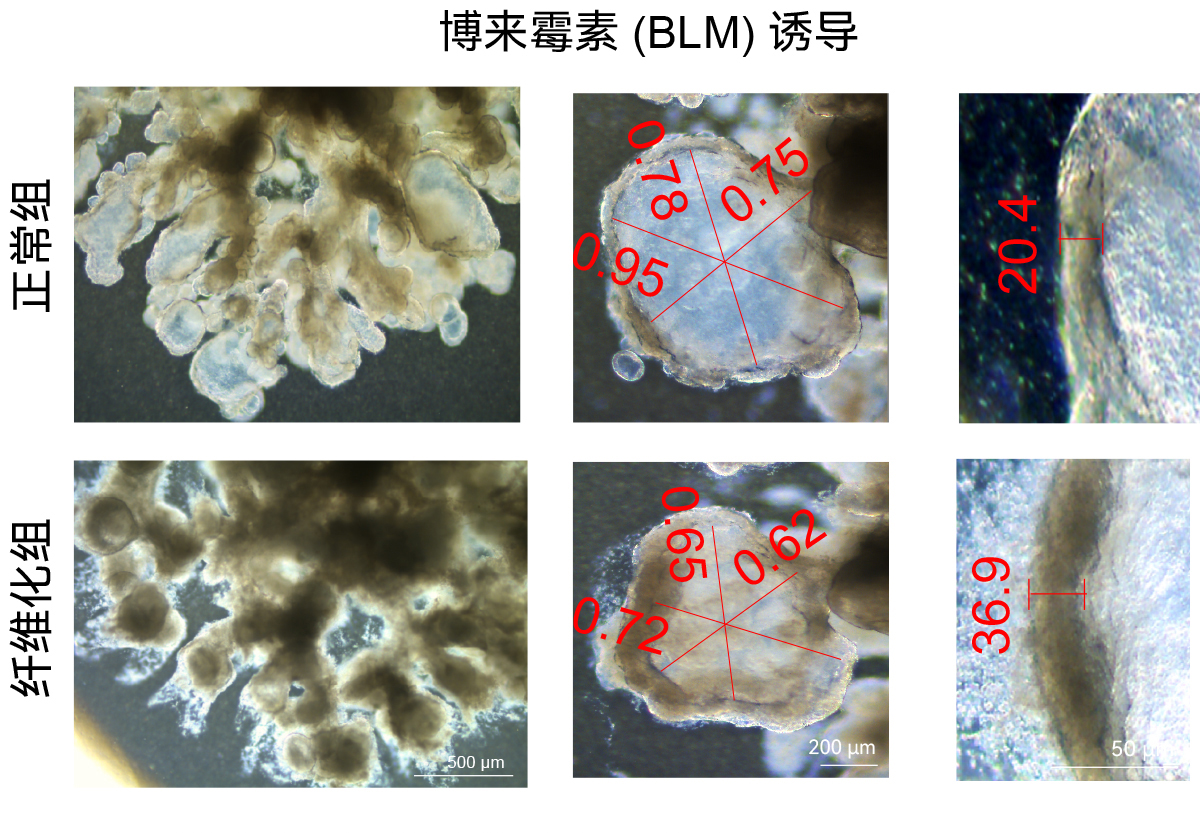 人多能干细胞向肺微器官分化系统(图1)