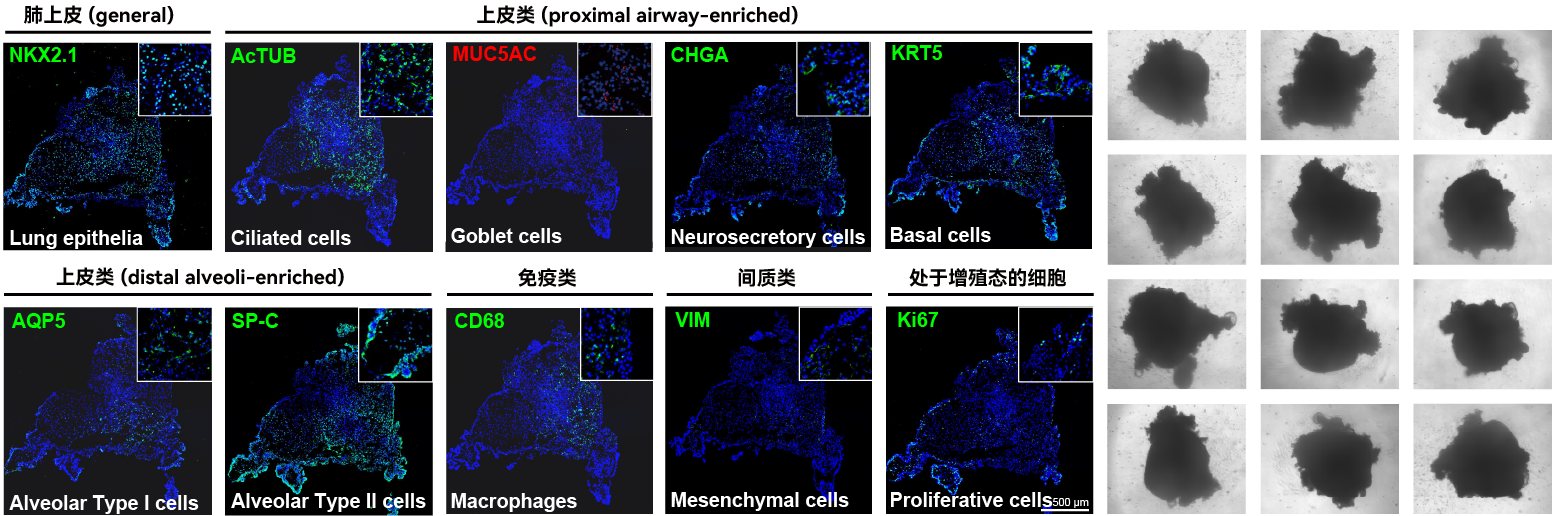 即用型iPSC源肺类器官 (d-model) ，3d0110.2(图1)