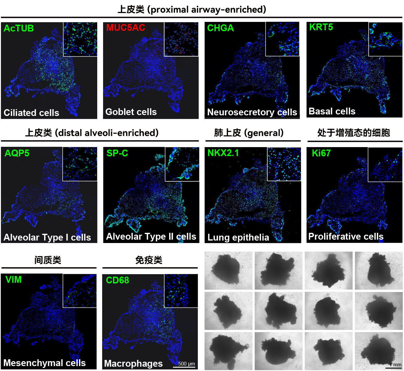 即用型iPSC源肺类器官 (d-model) ，3d0110.2(图1)